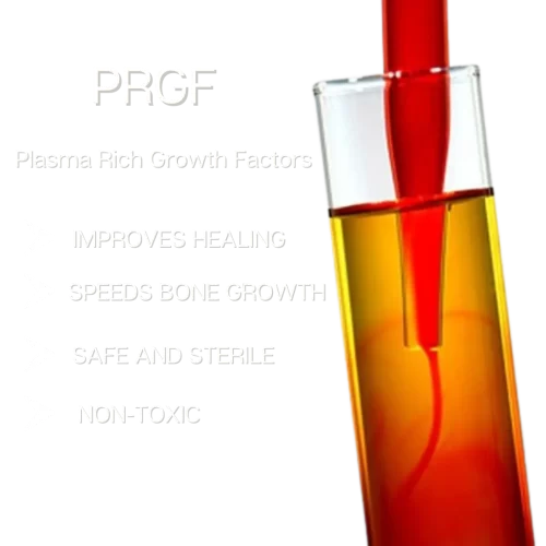 Plasma Rich in Growth Factors